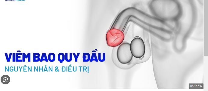 Dài bao quy đầu là gì? Ảnh hưởng của dài bao quy đầu đến sức khỏe nam giới